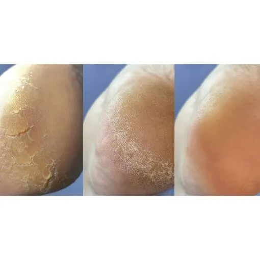 Крем від тріщин на шкірі рук та стоп з сечовиною 12%, 30 мл Podology+ NAILSOFTHEDAY